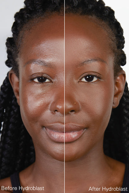 Hydroblast Finishing Powder