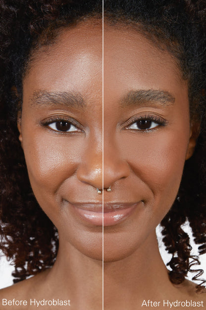 Hydroblast Finishing Powder