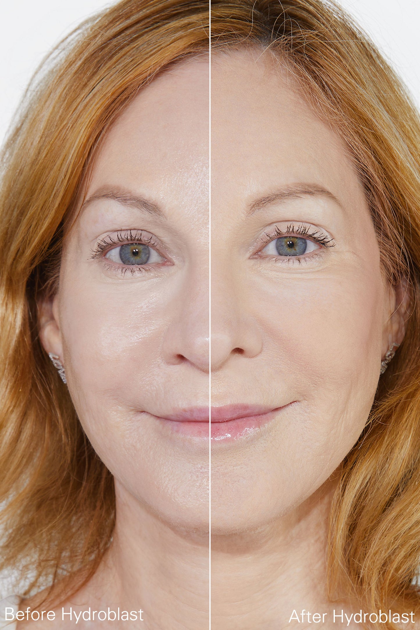 Hydroblast Finishing Powder