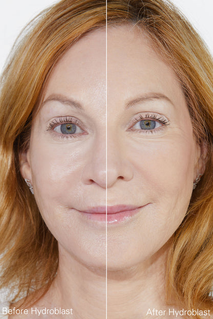 Hydroblast Finishing Powder